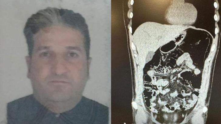 İranlı kuryenin midesinden 300 gram eroin çıktı