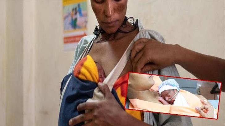 Ortalama kilonun altında ve prematüre bebeklere kanguru bakımı önerisi