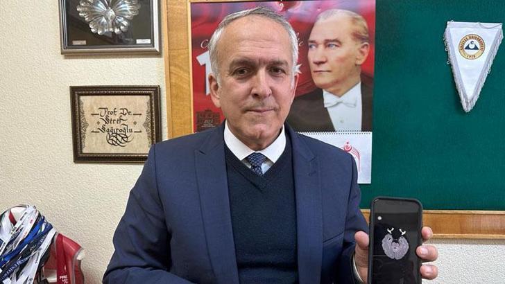 Tümör tespit eden 'yapay zeka algoritması'na yurt dışından talep