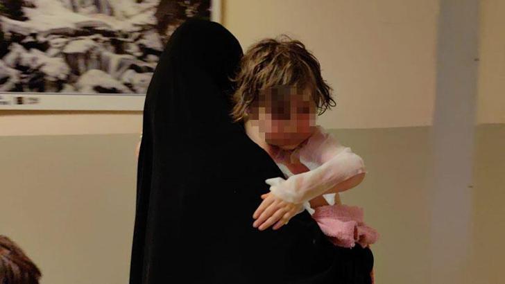 Üzerine kaynar su dökülen 4 yaşındaki Abir yaralandı