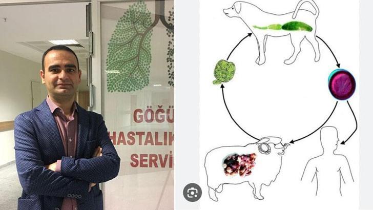 Uzman Dr. Perincek: Kist bulunan organlar gömülerek bertaraf edilmeli