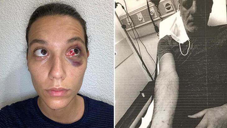 Deniz Bulutsuz ve Ozan Güven davasında adli tıp raporu mahkemeye ulaştı