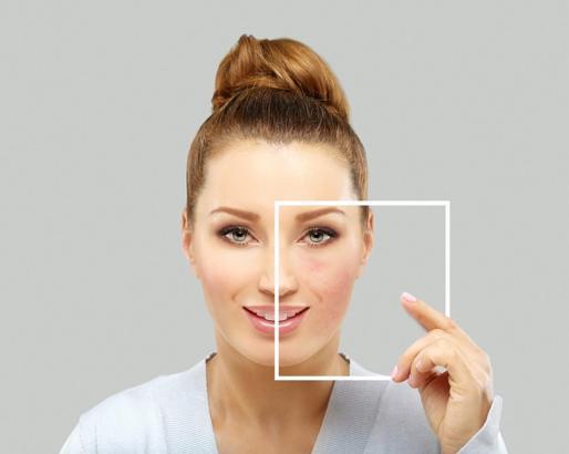 "Rosacea, kişiye özel uygulanacak doğru tedavilerle kontrol altına alınabilir"