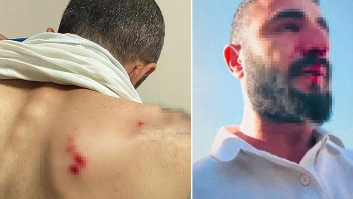 Kaçak elektrik kontrolü yapan ekibe saldıran 2 şüpheli gözaltına alındı