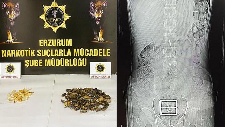 İranlı şüphelinin mide ve bağırsağından uyuşturucu çıktı