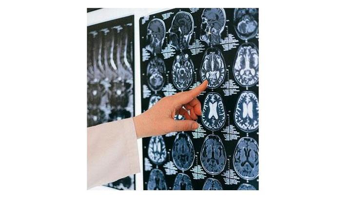 “Serebral palsili çocuklar için konforlu bir yaşam mümkün”