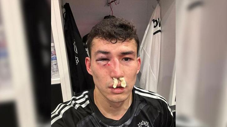 Zaynutdinov hastaneye kaldırıldı