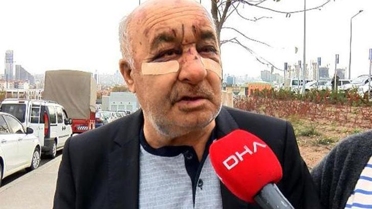 Ankara'da taksiciyi dövüp, gasbeden şüpheli yakalandı