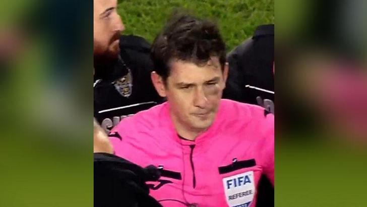 Halil Umut Meler’in beyin tomografisi çekildi