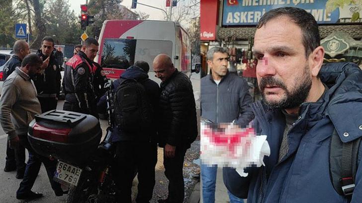 Minibüs sürücüsü, aracına motosikletiyle çarpan gazeteciyi darbetti