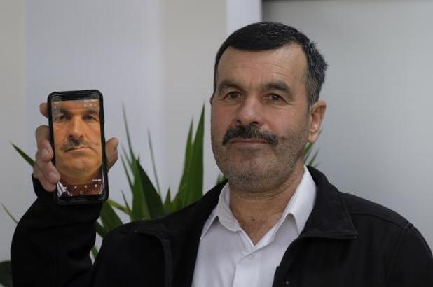 2 hastadaki sebebi bilinmeyen ağrı ve yüz bozulmasının nedeni 'tümör' çıktı