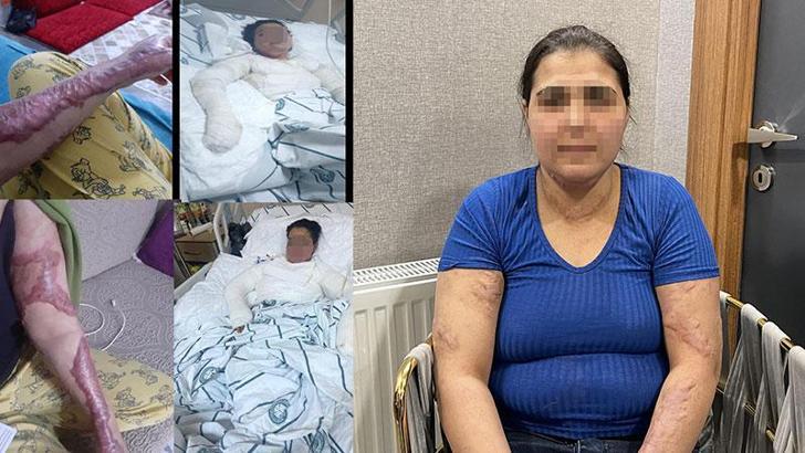 Eşinin ve kayınbiraderinin sıcak ütü basıp, kolonyayla yakmaya çalıştığı Yazgül; Beni öldürecekler