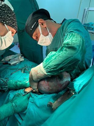 Karnından 10 kiloluk kitle çıktı