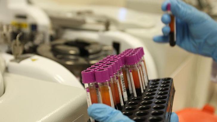 Karabük İl Sağlık Müdürlüğü'nden HIV ve HPV pozitif vakalarında artış iddiasına yalanlama