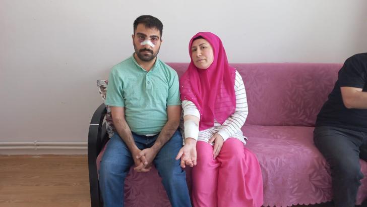 Engelli komşusunun burnunu kırıp, sıcak su ile yakan şüpheli adli kontrolle serbest