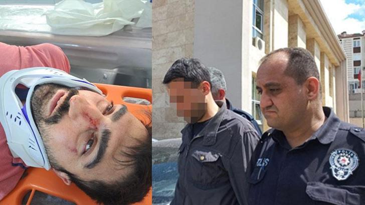 Engelli komşusunun burnunu kırıp, sıcak su ile yakan şüpheli adli kontrolle serbest