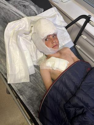 Köpeğin saldırdığı 7 yaşındaki Bilal, yaralandı