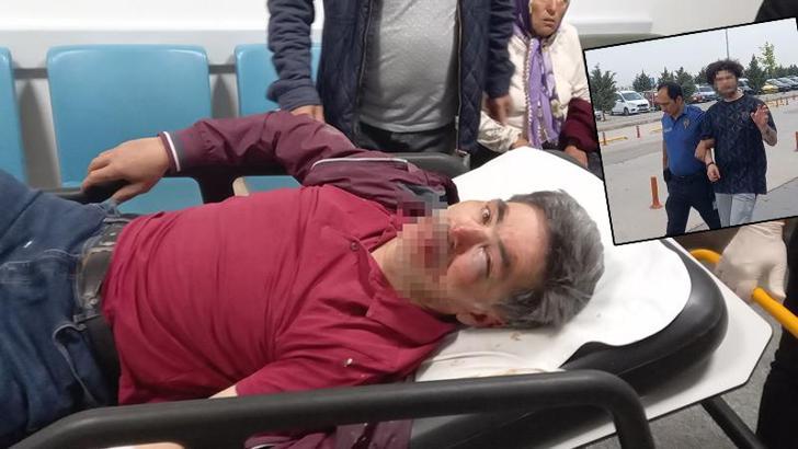 Kaldırımda yürürken darbedildi, yoğun bakıma alındı