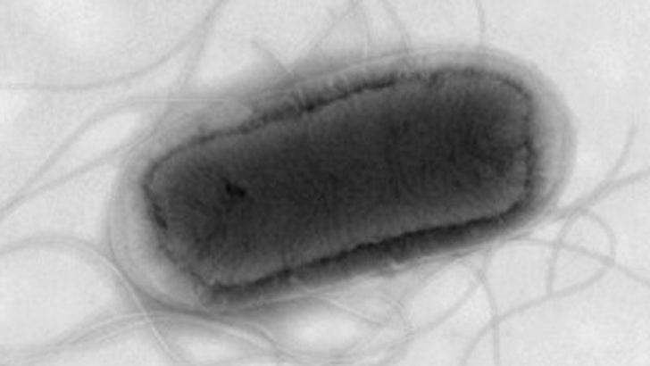 İngiltere’de gıdadan koli basili salgını: 113 vaka