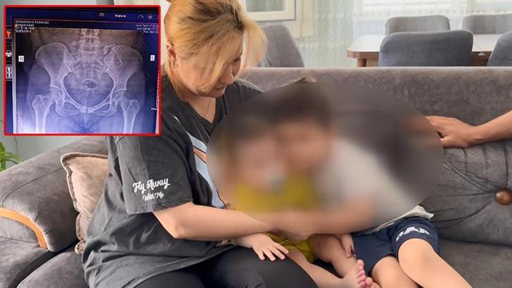 Sultanbeyli'de doğumda vücudunda unutulan gazlı bez 10 ay sonra fark edildi