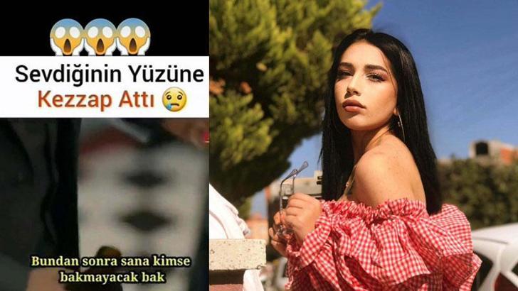 Masaj salonunda kadın çalışanın yüzüne kezzap atan sanık, 'Seni Bergen gibi yapacağım' demiş