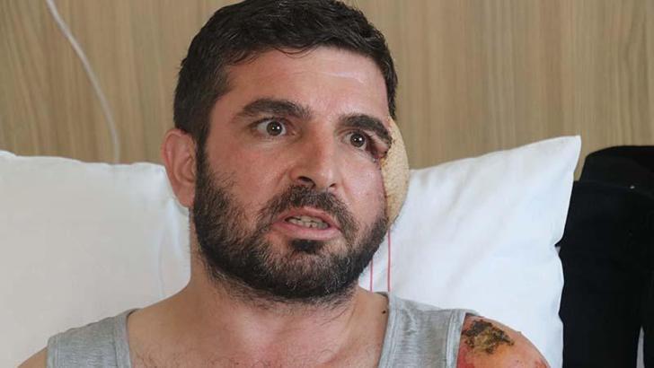 Çocuklarını kurtarmak için otomobilinin önüne atladı; yaralanan yüzüne bacağından doku nakli yapıldı