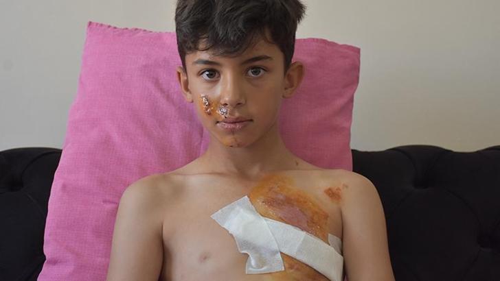 Duvarda açıkta kalan inşaat demiri, Gürkan'ın göğsüne saplandı