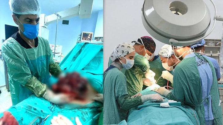 Yıllarca karnındaki 10 kiloluk kitleyle yaşamış