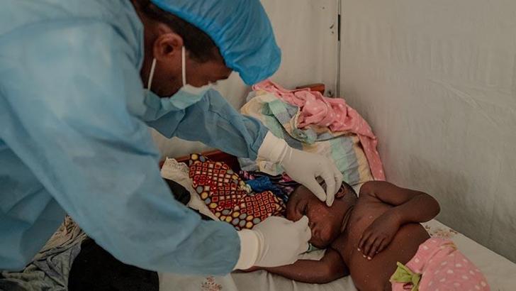 USAID, maymun çiçeğinden etkilenen bölgelere 35 milyon dolarlık yardım sağlayacak