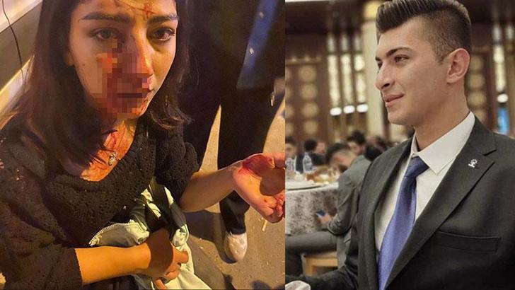Kırşehir'de genç kızın burnunu kıran AK Parti Keskin Gençlik Kolları Başkanı Ünlüer, serbest bırakıldı