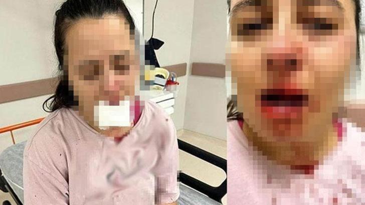 Balyozla saldırdığı yeğeninin çenesini ve 1 dişini kırdı