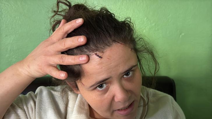 Kendisini darbeden eşi serbest bırakılan Keziban: Can güvenliğimden endişe ediyorum