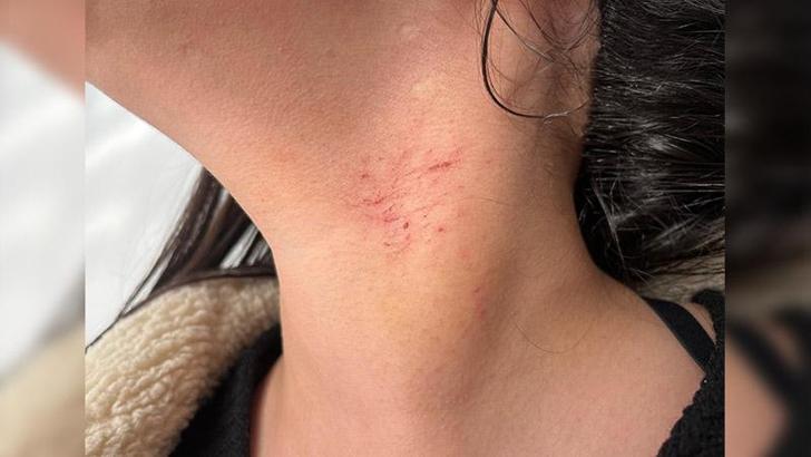 Cinsel saldırı iddiasına tutuklama