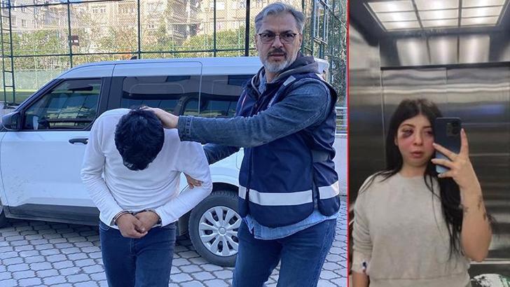 Sokak ortasında darbedilen Damla: Artık yüzümün sol tarafını hissetmiyorum