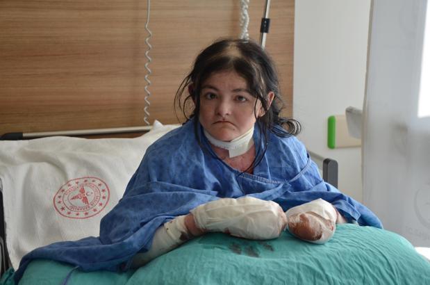 Amerikalı Arias'ın 20 yıldır kullanamadığı parmakları Eskişehir'deki operasyonla açıldı