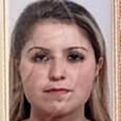 Gözde’nin evde vücudunda morluklar olan cansız bedeni bulundu