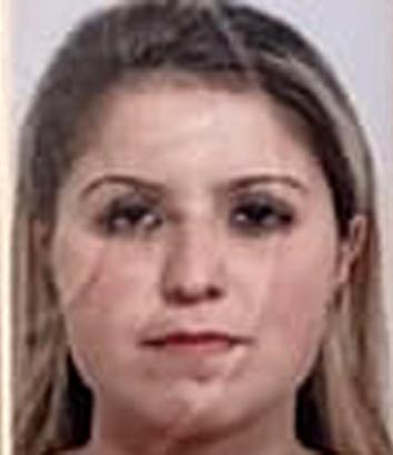 Ölü bulunan Gözde'nin vücudundaki morluklar, 3-4 günlükmüş