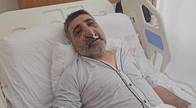 İstanbul - İngiliz boksörün darbettiği taksici konuştu