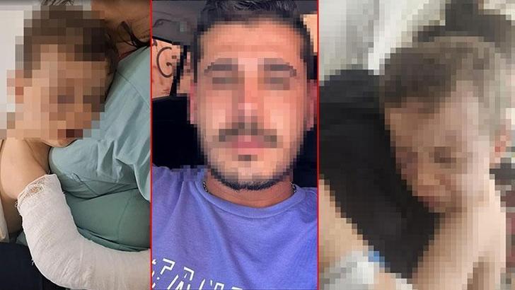 2 yaşındaki çocuğa vahşeti yaşattı; çocuk yoğun bakımda, anne ile sevgilisi gözaltında