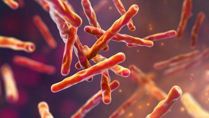 Florida’da tüberküloz vakası tespit edildi