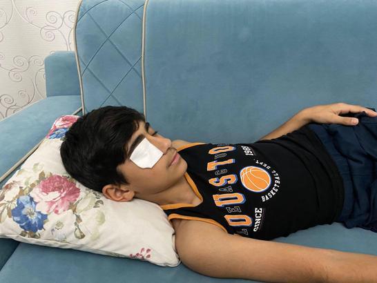 Yapıştırıcı sıçrayınca kapanan göz kapağı doktor müdahalesiyle açıldı