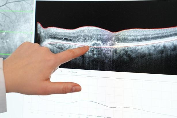 ‘Erken teşhisle görme kaybının önüne geçmek mümkün’