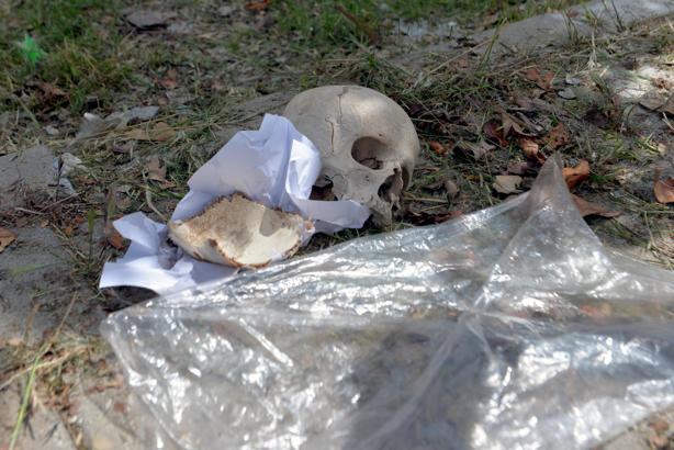 Çöpten kağıda sarılı insan kafatası çıktı