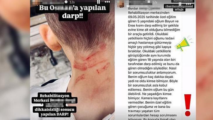Rehabilitasyon merkezinde 5 yaşında çocuğa darp iddiasına soruşturma