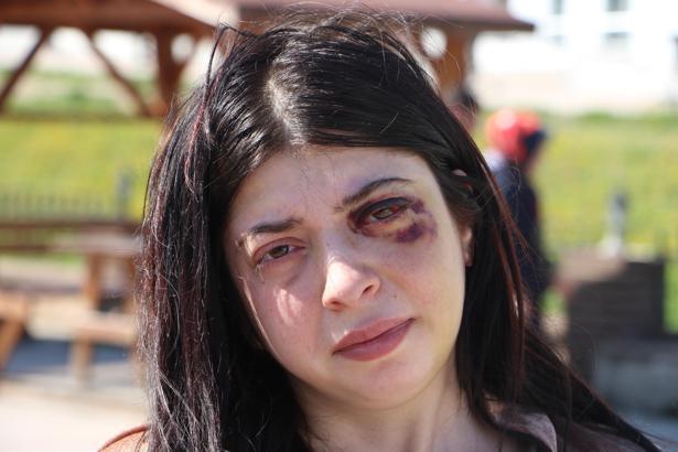 Sokak ortasında darbedilen Damla: Platinler hep yüzümde kalacakmış