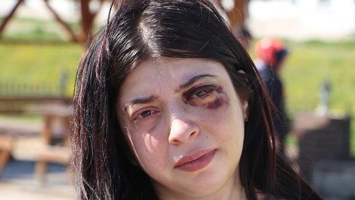 Sokak ortasında darbedilen Damla: Platinler hep yüzümde kalacakmış