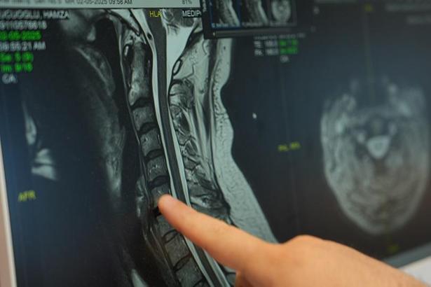 ‘Teknolojik cihazların yoğun kullanımı ‘tekno boyun’ problemine yol açıyor’