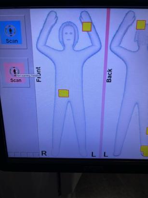 İstanbul- İstanbul Havalimanı’nda 3 kadının cinsel organlarında 6 kilo altın ele geçirildi