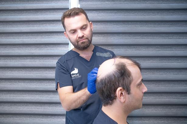 'Hormonal saç dökülmesinde, ekim doğal çözümdür'