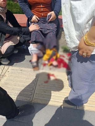 Husumetlilerin silahlı kavgasında yoldan geçen kadın bacağından vuruldu